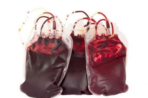 Тромбоциты (концентрат тромбоцитов), аферез